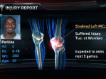 Perkins Injury Report
